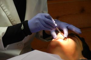 Root Canal Treatment